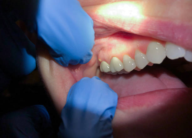 Best Walk-In Emergency Dentist in Centrevle, IL